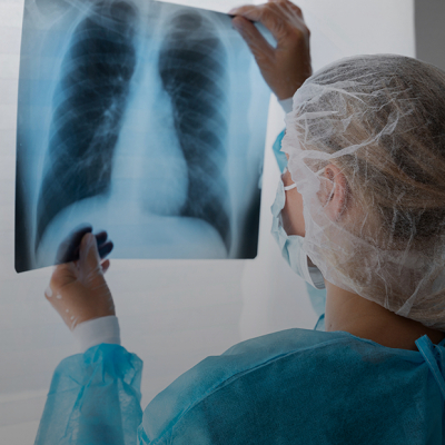 «Моей самой молодой пациентке с четвертой стадией рака всего 22 года»